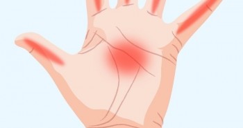 7 dấu hiệu xuất hiện ở bàn tay báo hiệu về sức khỏe của bạn