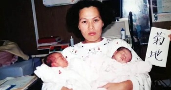 Cặp sinh đôi kỳ lạ nhất thế giới: Chào đời giống y đúc, ngoại hình lúc trưởng thành gây bất ngờ