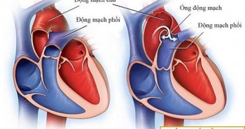 Cách trái tim hoạt động và bơm máu khắp cơ thể