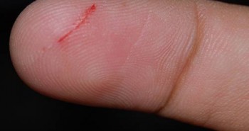 Vì sao đứt tay do giấy cứa đau hơn cả dao?