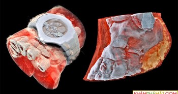 Đây là hình ảnh X-quang màu 3D đầu tiên trên thế giới, đừng xem nếu bạn yếu tim