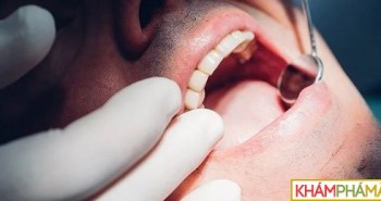 Vì sao cần khám răng trước khi phẫu thuật ung thư?
