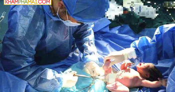 Khi bác sĩ cắt dây rốn cho trẻ sơ sinh, mẹ hay con đau hơn, nhiều người đoán sai