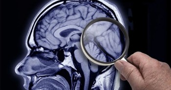 Mỹ không tìm thấy bằng chứng tổn thương não do "Hội chứng Havana"