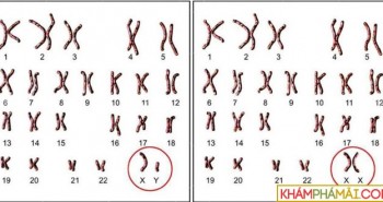 Nữ là XX, nam là XY, nhưng tại sao không có nhiễm sắc thể YY?