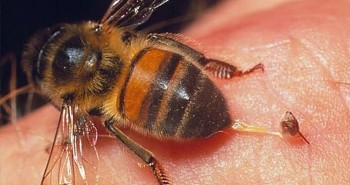 Cách xử lý khi bị ong đốt