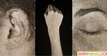 Tác hại của tia UV lên da qua ống kính nhiếp ảnh gia người Pháp