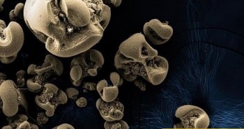 Phát hiện vi khuẩn ăn kim loại sau một thế kỷ tìm kiếm
