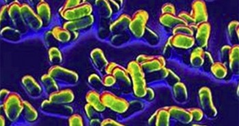 Tại sao vi khuẩn dịch hạch không thể bị diệt trừ hoàn toàn trên hành tinh?
