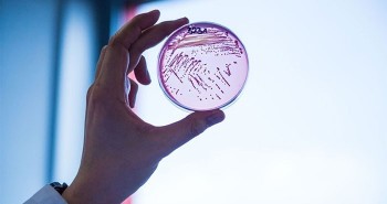 Giới khoa học phát hiện vi khuẩn "ma cà rồng" khát máu người