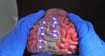 "Xăm" hình lên... não để điều trị bệnh, bước tiến mới của các nhà khoa học