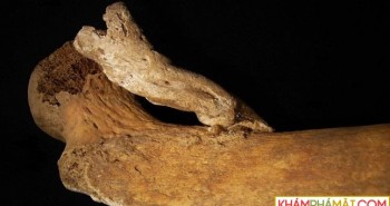 Giải mã bộ xương đùi bí ẩn của một phụ nữ từ thế kỷ 14-19